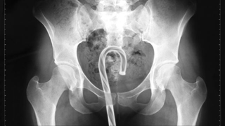What Did We Get Stuck In Our Rectums Last Year?